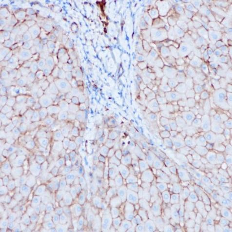 CD138 Rabbit Monoclonal Antibody(ARA768)