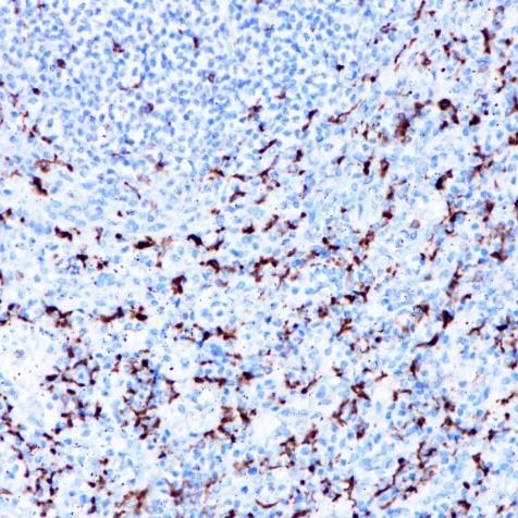 CD68 Rabbit Monoclonal Antibody(ARA769)