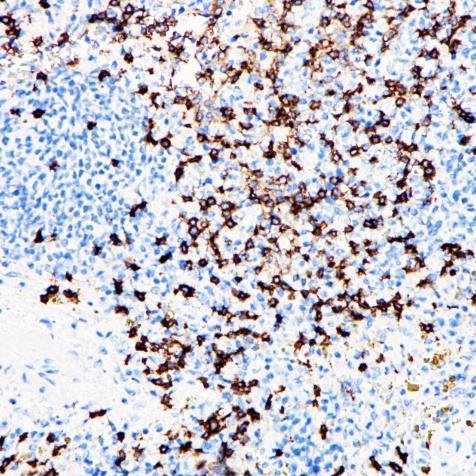 CD8a Rabbit Monoclonal Antibody(ARA772)