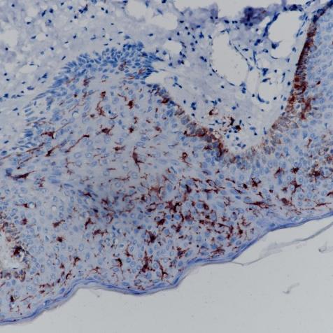 CD1a Rabbit Monoclonal Antibody(ARA774)