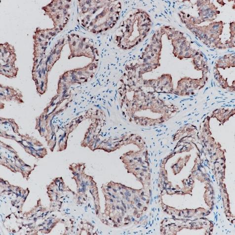 PSA Rabbit Monoclonal Antibody(ARA775)