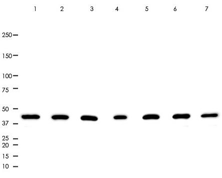 Actin Rabbit Monoclonal Antibody(ARA776)