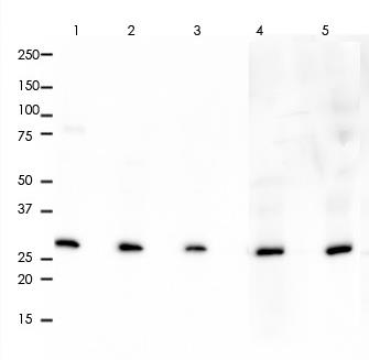 CDK2 Rabbit Monoclonal Antibody(ARA779)