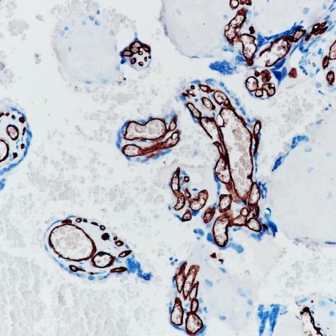 CD34 Rabbit Monoclonal Antibody(ARA785)
