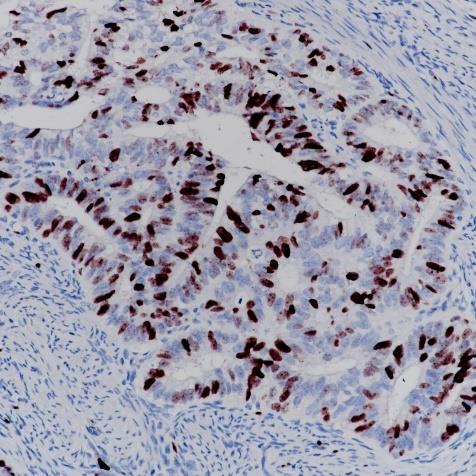 Ki-67 Rabbit Monoclonal Antibody(ARA786)
