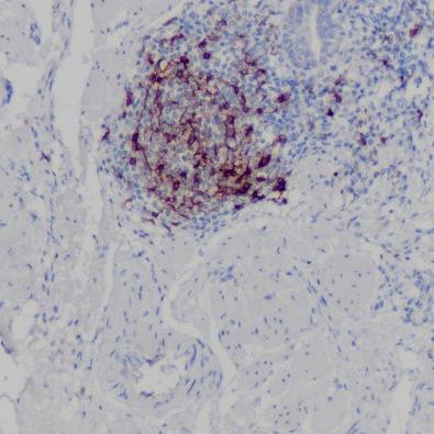 CD23 Rabbit Monoclonal Antibody(ARA787)