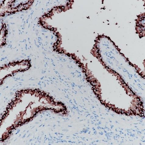 Prostatic Acid Phosphatase Rabbit Monoclonal Antibody(ARA788)