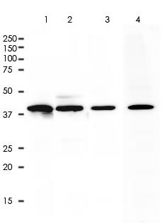 Cytokeratin 19 Rabbit Monoclonal Antibody(ARA789)