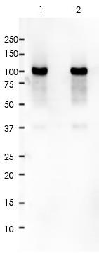 CD10 Rabbit Monoclonal Antibody(ARA790)