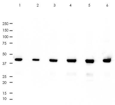 Cytokeratin 18 Rabbit Monoclonal Antibody(ARA800)