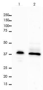 EpCAM Rabbit Monoclonal Antibody(ARA801)