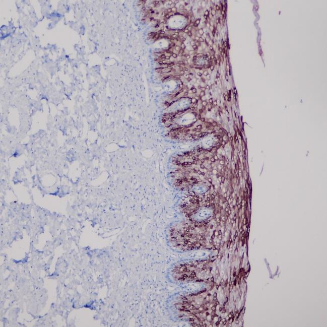 Cytokeratin 10 Rabbit Monoclonal Antibody(ARA802)
