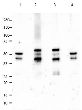 Type-II Cytokeratins Rabbit Monoclonal Antibody(ARA803)