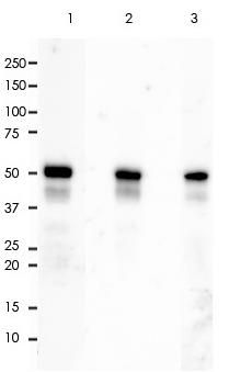 Cytokeratin 7 Rabbit Monoclonal Antibody(ARA806)