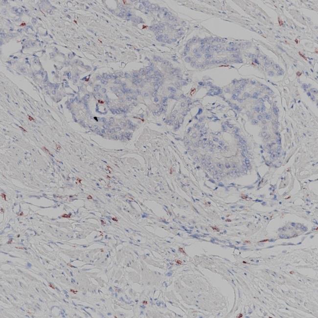 CD117 Rabbit Monoclonal Antibody(ARA808)