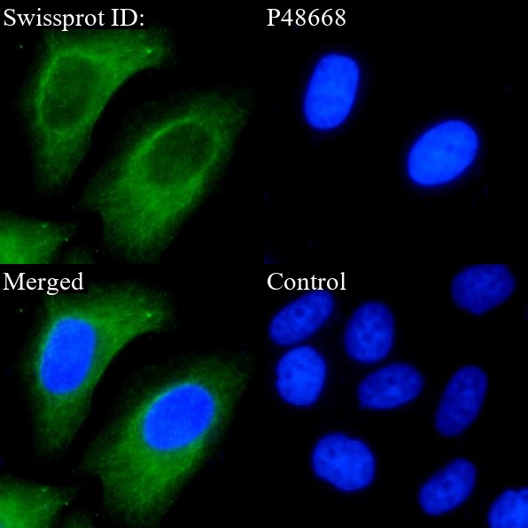 Cytokeratin 6A/B/C Rabbit Monoclonal Antibody(ARA809)