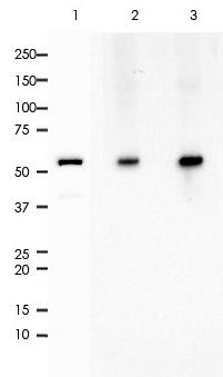 Cytokeratin 6A/B/C Rabbit Monoclonal Antibody(ARA810)