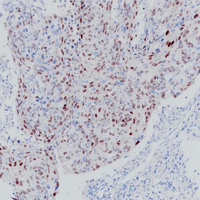 p21 Rabbit Monoclonal Antibody(ARA814)