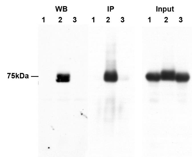 p-RIPK1(S166) Rabbit Monoclonal Antibody(YJY-1-5)