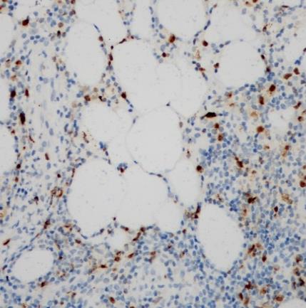 Granzyme B Rabbit Monoclonal Antibody(ARA816)