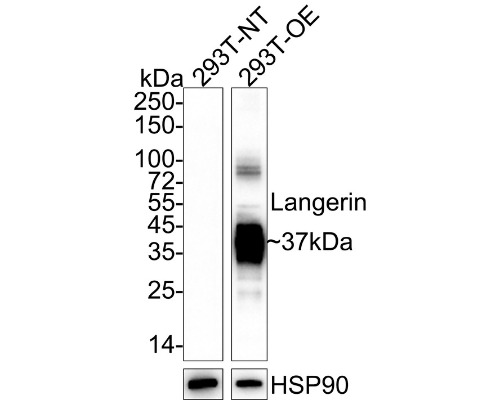 Langerin / CD207 Rabbit Monoclonal Antibody(ARA823)