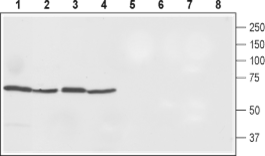 FPN1/Ferroportin/SLC40A1 Rabbit Polyclonal Antibody
