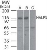 NLRP3 Rabbit Polyclonal Antibody