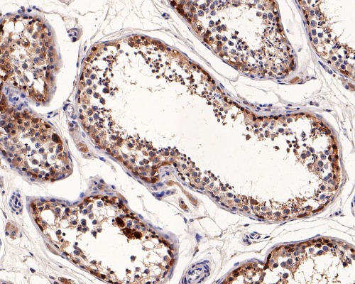 CTAG1A/NY-ESO-1 Rabbit Monoclonal Antibody