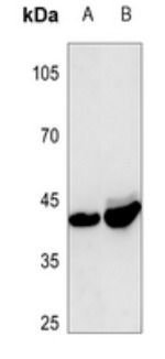 Follistatin Rabbit Polyclonal Antibody