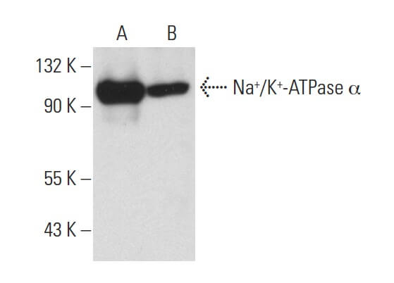 H+/K+ ATPase &beta; Mouse Monoclonal Antibody(ARA827)