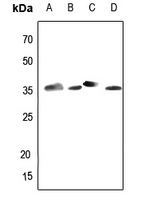 Aldose Reductase Rabbit Polyclonal Antibody