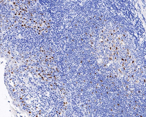 SOX9 Rabbit Monoclonal Antibody(ARA829)