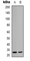 HMGB2 Rabbit Polyclonal Antibody