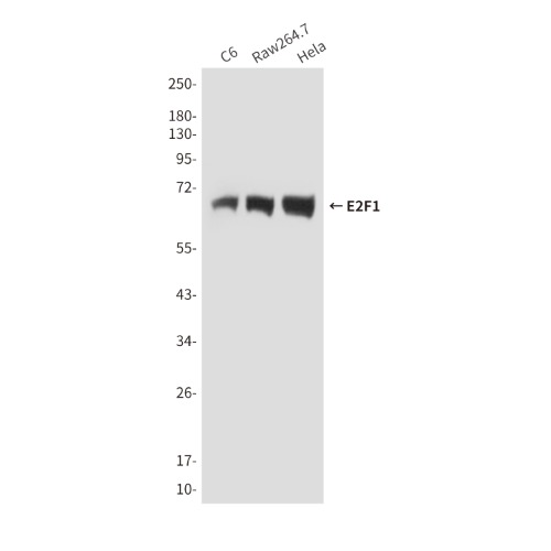 E2F1 Mouse Monoclonal Antibody(ARA832)