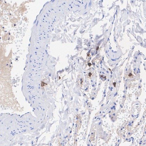 Mast Cell Tryptase Rabbit Monoclonal Antibody(ARA833)