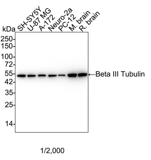 Beta III Tubulin Mouse Monoclonal Antibody(ARA835)