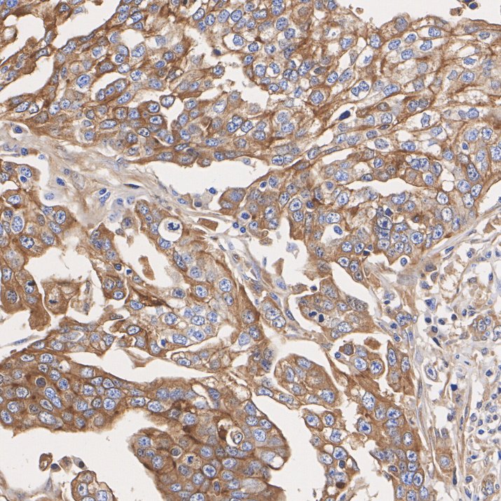 Mesothelin Rabbit Monoclonal Antibody(ARA837)