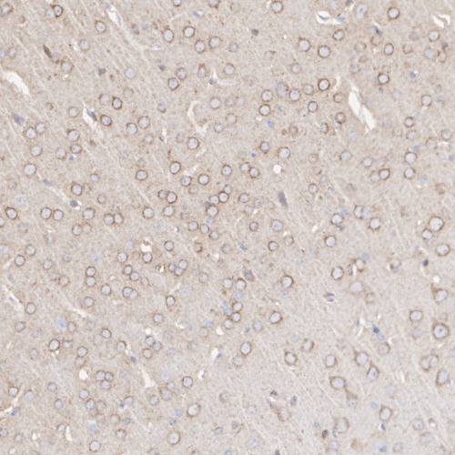 LRP1 Rabbit Monoclonal Antibody(ARA839)