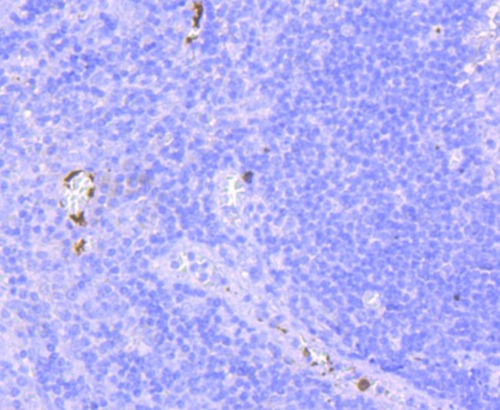 CD41 Rabbit Monoclonal Antibody(ARA842)