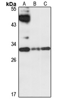 Kallikrein 13 Rabbit Polyclonal Antibody