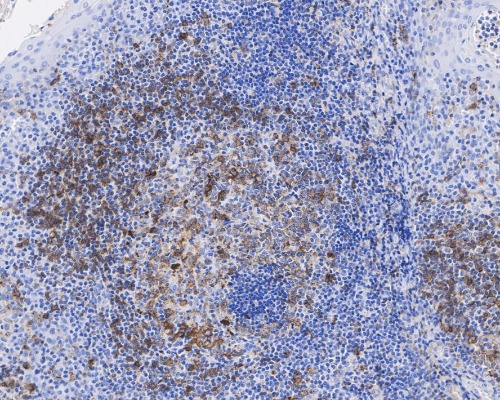 HLA Class II DRB1 Rabbit Monoclonal Antibody(ARA843)