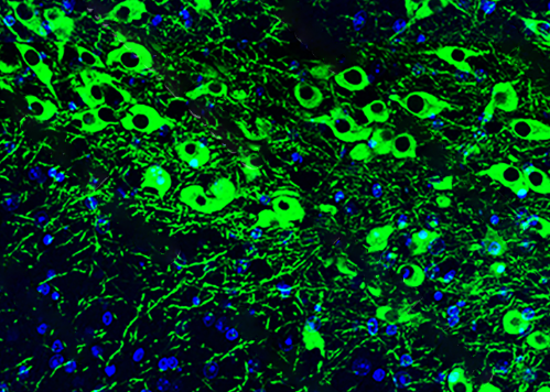 TH(tyrosine hydroxylase) Guinea pig Polyclonal Antibody