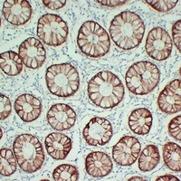 Claudin 4 Mouse Monoclonal Antibody(ARA845)