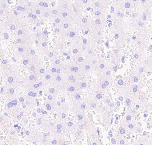 Pit1 Rabbit Monoclonal Antibody(ARA847)