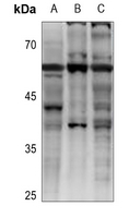GPCR19 Rabbit Polyclonal Antibody