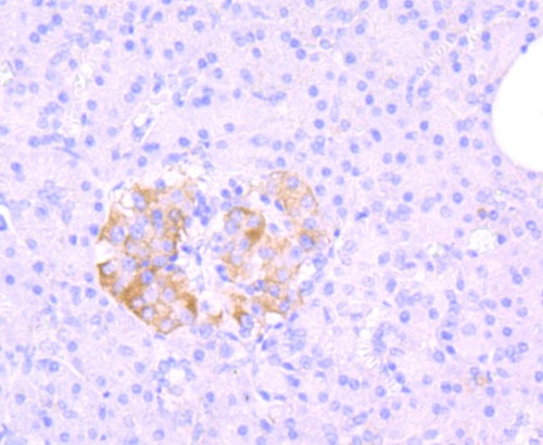 MRP1 Rabbit Monoclonal Antibody(ARA850)