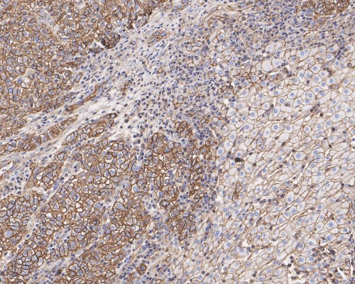 P-Glycoprotein Mouse Monoclonal Antibody(ARA851)
