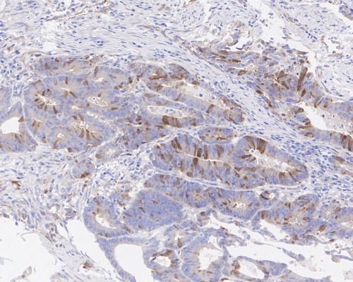 PLK1 Rabbit Monoclonal Antibody(ARA859)