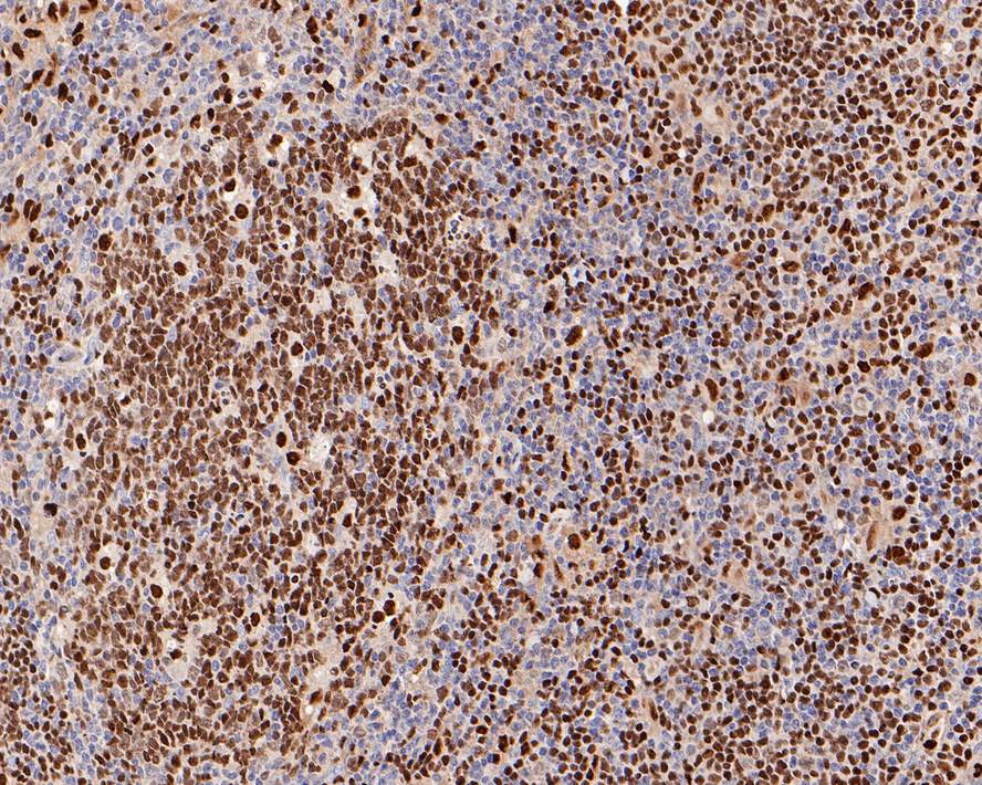 PU.1/Spi1 Rabbit Monoclonal Antibody(ARA872)