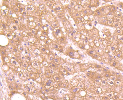 Aggrecan Rabbit Monoclonal Antibody(ARA879)